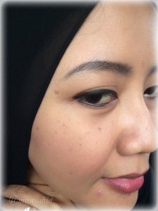 Penampakan noda flek hitam di wajah
